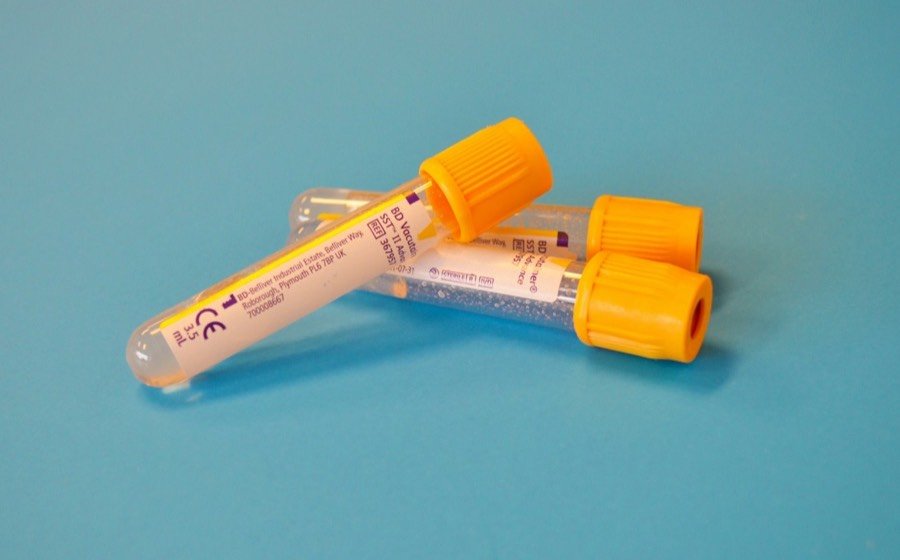 Blood sample collection tubes